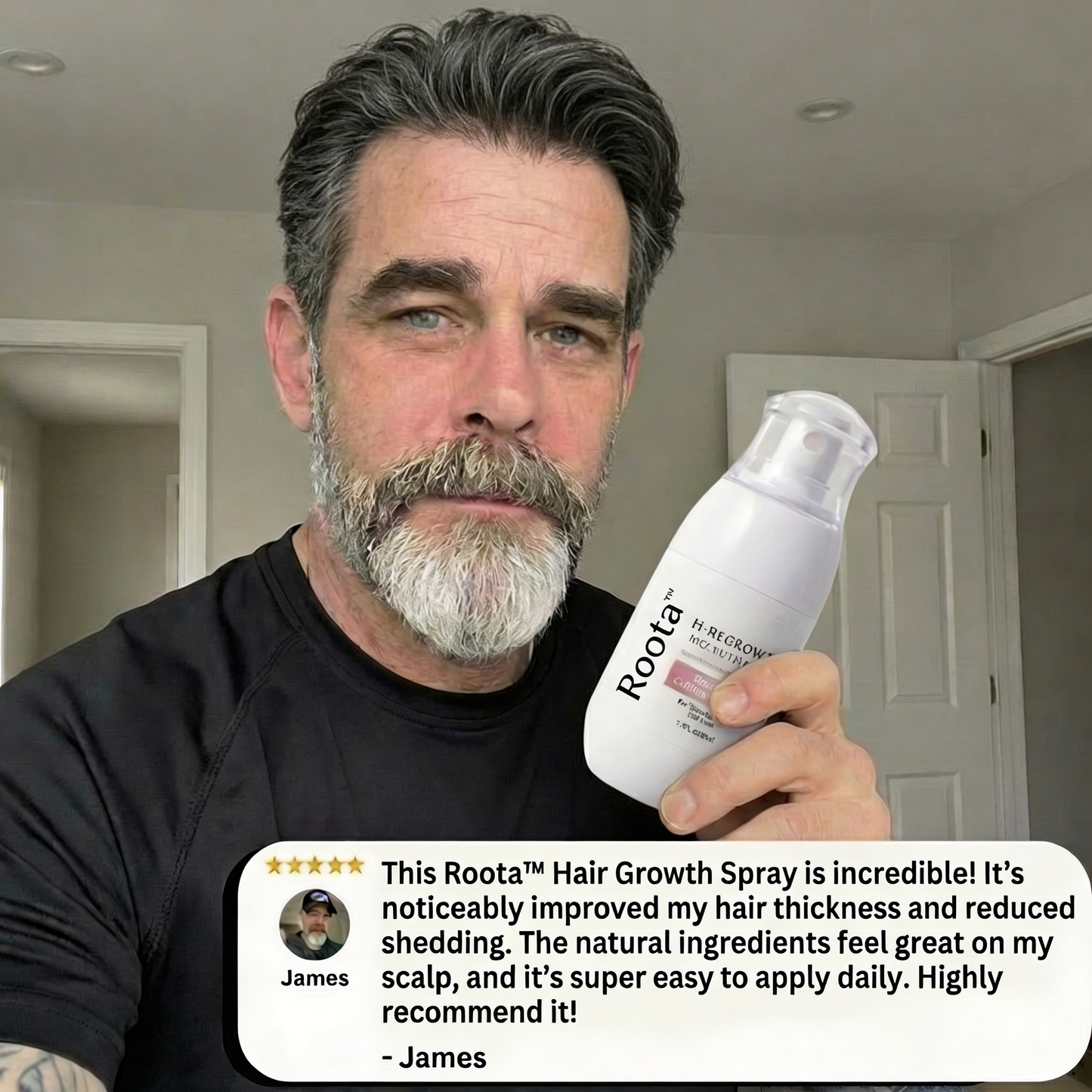 Roota™ Hair Growth Spray